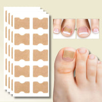 10+10 GRATIS | FixaNail - Sofortige Nagelreparatur