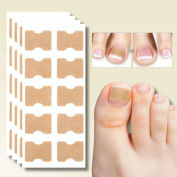 10+10 GRATIS | FixaNail - Sofortige Nagelreparatur