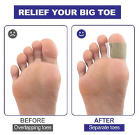2PC Gel Toe Spacers Bunion Corrector with Loops Portable Toe Separators for Bunion Overlap Toe Hammer Toe Big Toe Alignment